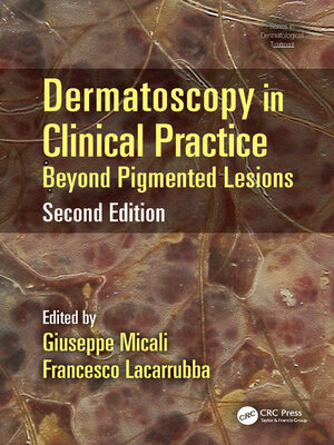 cover image of Dermatoscopy in Clinical Practice